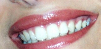 Dentista senza prenotazione a Roma, all’Isola Tiberina visite immediate per urgenze e controlli