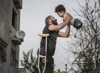 Arrivano a Siena Munzir e Mustafa, padre e figlio siriani mutilati dalla guerra. Una nuova vita grazie a una foto simbolo Munzir e Mustafa