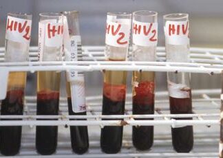 ‘Parliamo di Hiv oggi. Per guardare al domani’, al via la seconda stagione del webinar promosso da Adnkronos