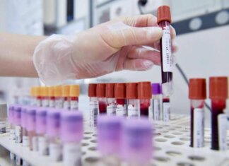 Dal microbiota una speranza contro l’epilessia resistente, lo studio italiano