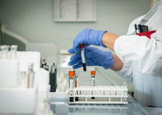 Test del sangue prevede prognosi patologia renale, lo studio