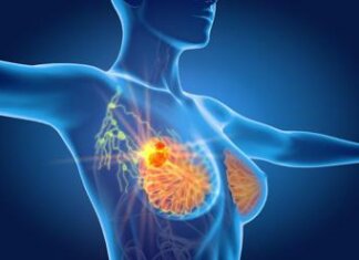 Nuovo cancro seno ereditario, Aiom: “Passo avanti per diagnosi di precisione”