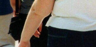 Una morte per malattie infettive su 10 è legata all’obesità, lo studio