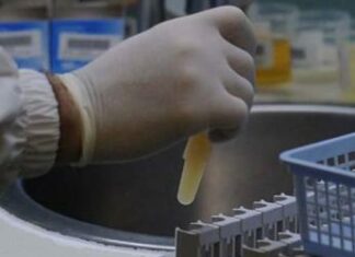 Virus del morbillo trovato nelle fogne, virologa avverte: “Molte infezioni sommerse”