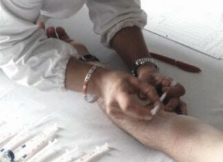 Allergia al nickel in aumento, l’immunologo “nuoce al 10% della popolazione”