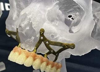 Dr. Claudio Mocci (Dent.AL.): “Nuovi traguardi per l’implantologia avanzata: dall’utilizzo di sistemi hi-tech all’approccio multi-disciplinare nutrizionale”