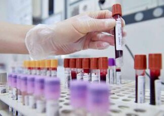 Leucemia acuta promielocitica, esperti: “Verso cura con sola terapia orale”