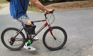 Protesi ortopediche triplicate e 20mila l’anno scadono, boom revisioni