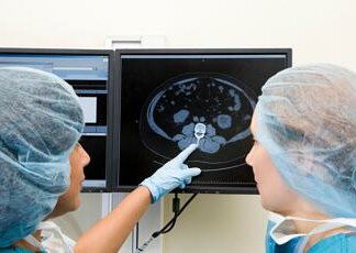 Kinsella e il cancro al cervello, cos’è il glioblastoma che l’ha colpita
