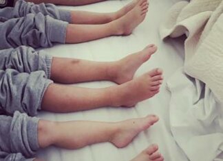 Dal ginocchio valgo al piede piatto, i difetti nei bimbi: cosa fare e quando preoccuparsi