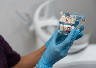 Implantologia dentale, in Italia nascono nuove tecniche e soluzioni pensate anche per i pazienti problematici