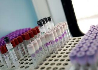 Ricerca, proteina sangue albumina predice rischio cancro e infarto in ‘over 65’