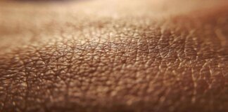 Dermatite atopica, quando la pelle condiziona la vita, ‘Diari atipici’ dà voce ai pazienti