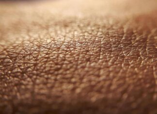 Dermatite atopica, quando la pelle condiziona la vita, ‘Diari atipici’ dà voce ai pazienti
