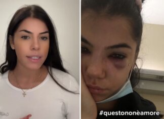 Violenza sulle donne, in lacrime Chiara Balistreri: “Il mio ex violento è tornato a casa” – Video