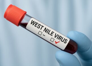 Anziano ucciso dal West Nile virus: era ricoverato all’ospedale Misericordia di Grosseto West Nile virus