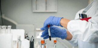 Alzheimer, test del sangue possono prevedere l’inizio dei sintomi