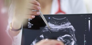 Chirurgia, si rompe l’aorta e viene operata con il bimbo in utero, intervento record a Milano