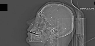 L’inchiesta horror sulle violenze iraniane: ‘Manifestanti uccisi e colpiti nelle parti vitali’