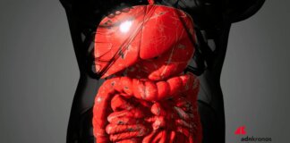 Malattia di Crohn, solo 1 paziente su 3 riceve supporto nutrizionale