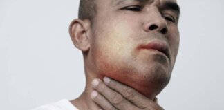 Angioedema ereditario, Aifa estende uso lanadelumab dai 2 anni di età