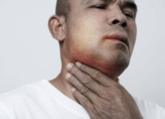 Angioedema ereditario, Aifa estende uso lanadelumab dai 2 anni di età