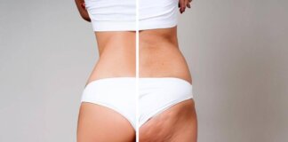 Gambe gonfie e cellulite per 8 donne su 10: la cura riparte dal sistema linfatico
