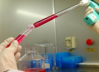 Melanoma uveale metastatico: “Tebentafusp raddoppia sopravvivenza a 5 anni”