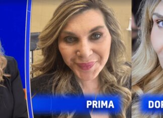 Nadia Rinaldi, il dramma dopo l’intervento: “Ho vissuto un anno senza seno”