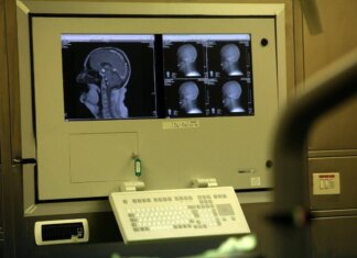 Sogni agitati sintomo Parkinson? Medici anti-bufale ‘può accadere, si fa polisonnografia’