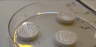 Microaghi digitali e smartphone contro l’Alzheimer: la diagnosi arriva con vent’anni di anticipo unipi