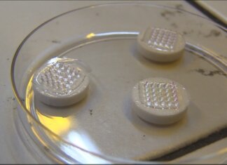 Microaghi digitali e smartphone contro l’Alzheimer: la diagnosi arriva con vent’anni di anticipo unipi