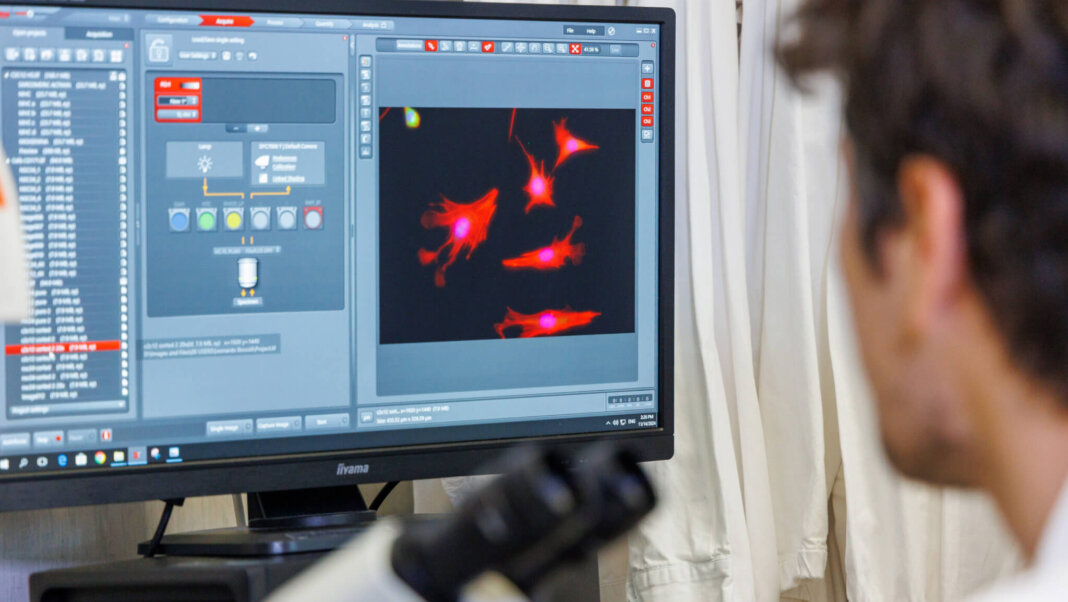 Ultrasuoni per combattere la neuroinfiammazione studio Nature