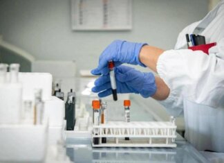 Alzheimer, nuovo test del sangue potrebbe prevedere sintomi imminenti