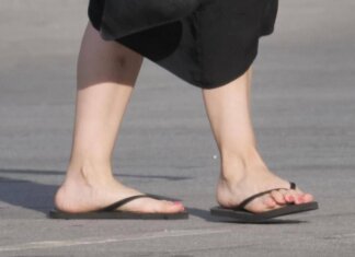 Infradito fanno bene o male ai piedi? Il parere del medico: “Ecco chi non deve usarle”