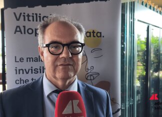 Costanzo (Sidemast): “Upadacitinib blocca cellule infiammatorie in vitiligine e alopecia areata”
