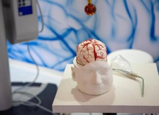 Dai gliomi al Parkinson, così l’intelligenza artificiale aiuta la Neurochirurgia