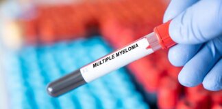 Mieloma multiplo, remissione a 5 anni con terapia Car-T cilta-cel in linee precoci