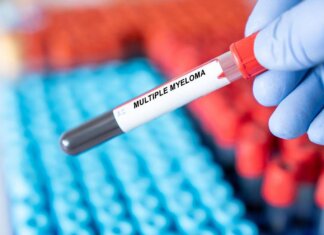 Mieloma multiplo, remissione a 5 anni con terapia Car-T cilta-cel in linee precoci