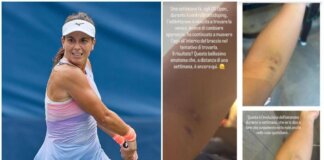 US Open, Stefanini e il livido sul braccio: “Colpa di un controllo antidoping…”