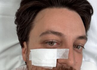 Veneto, il presidente Alberto Stefani ferito in un incidente stradale: stava andando al consiglio federale della Lega a Milano