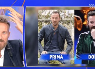 Francesco Facchinetti, la battaglia contro la calvizie: “Ho trovato la pace con una patch cutanea”