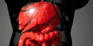Malattie infiammatorie intestinali, rimborsabile guselkumab per colite ulcerosa e Crohn