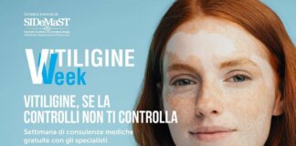 Vitiligine week, Sidemast: “Circa mille consulenze dermatologiche gratuite”